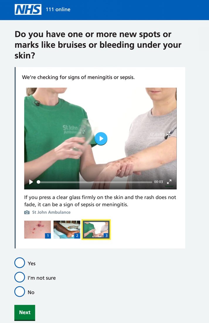 Screen grab of 111 online triage question showing a video demonstrating how to check for a non-fading rash