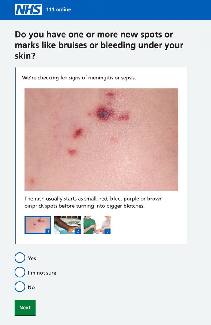Screen grab of 111 online triage question showing an image of an early-stage meningitis rash.